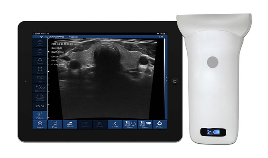 Ecógrafo de bolsillo Sonostar Lineal Musculoesquelético