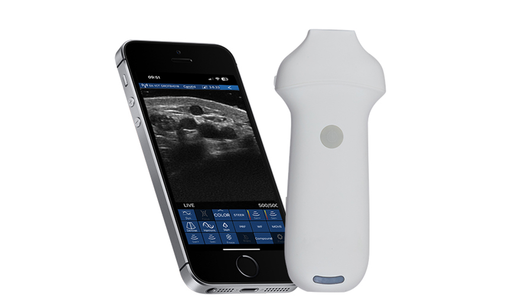 Sonostar PA+ Phased Array Cardiología