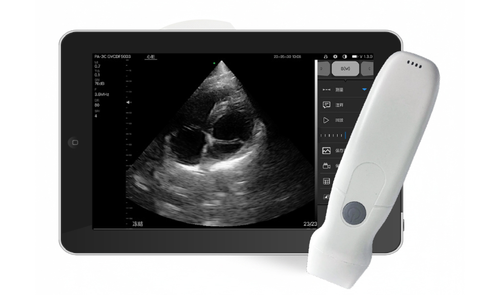Sonostar PA+ Phased Array Cardiología