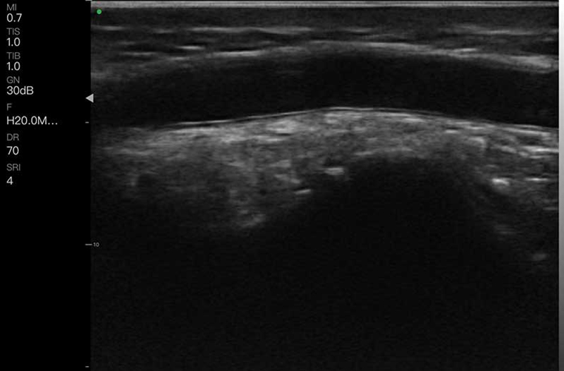 Dermatología alta resolución