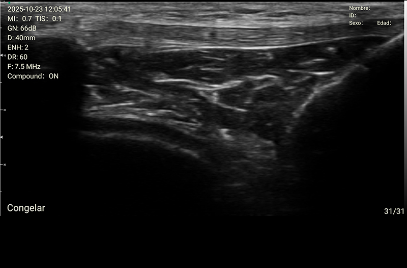 Musculoesquelética