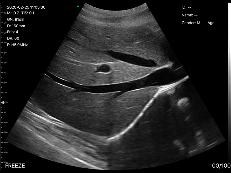 Abdominal · Doppler MSK