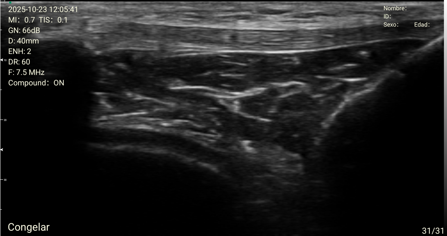 Doppler vascular · MSK