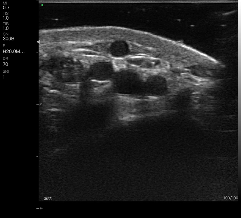 Abdomen · Doppler vascular